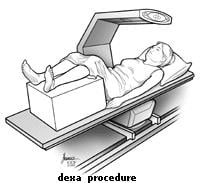 10683 dexa scan