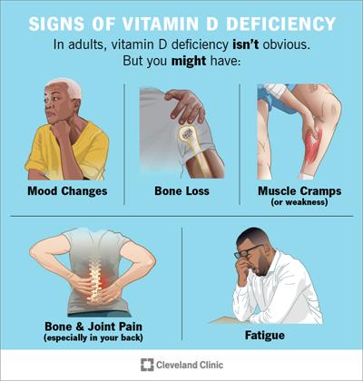 15050 vitamin d deficiency