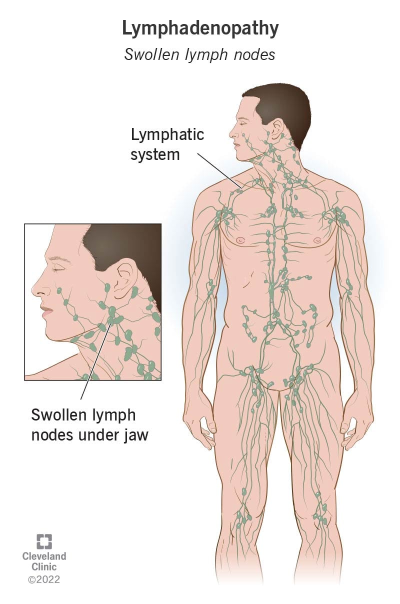 black-eye-periorbital-haematoma-causes-symptoms-risk-factor-and