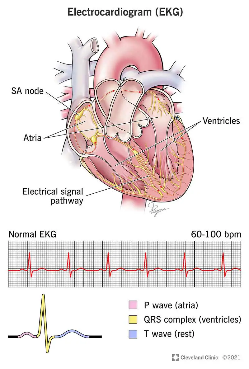 Ilustrācija, kā EKG uzrauga sirds elektrisko aktivitāti.