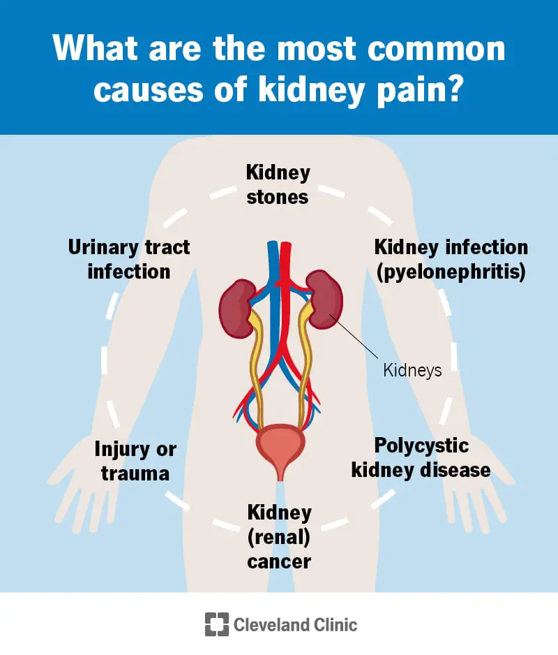 17688 kidney pain