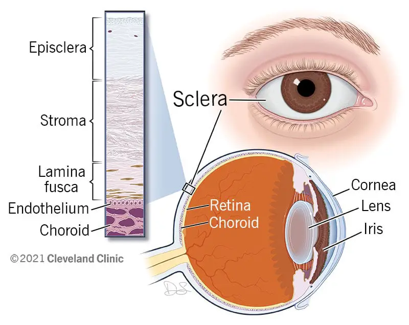 22088 sclera