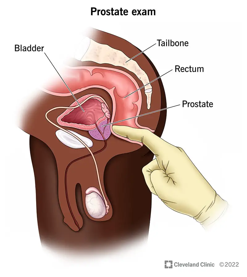 22764 prostate