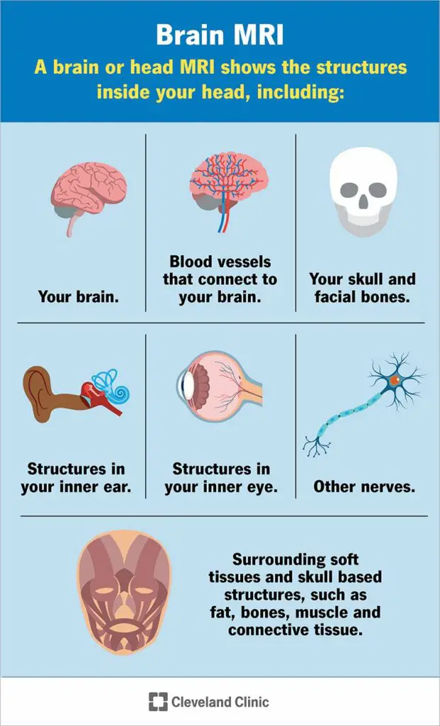 22966 brain mri