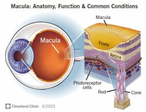 23185 macula