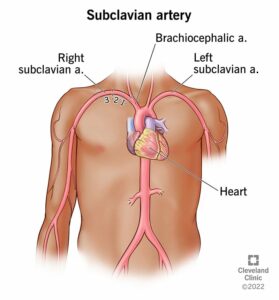 23990 subclavian artery