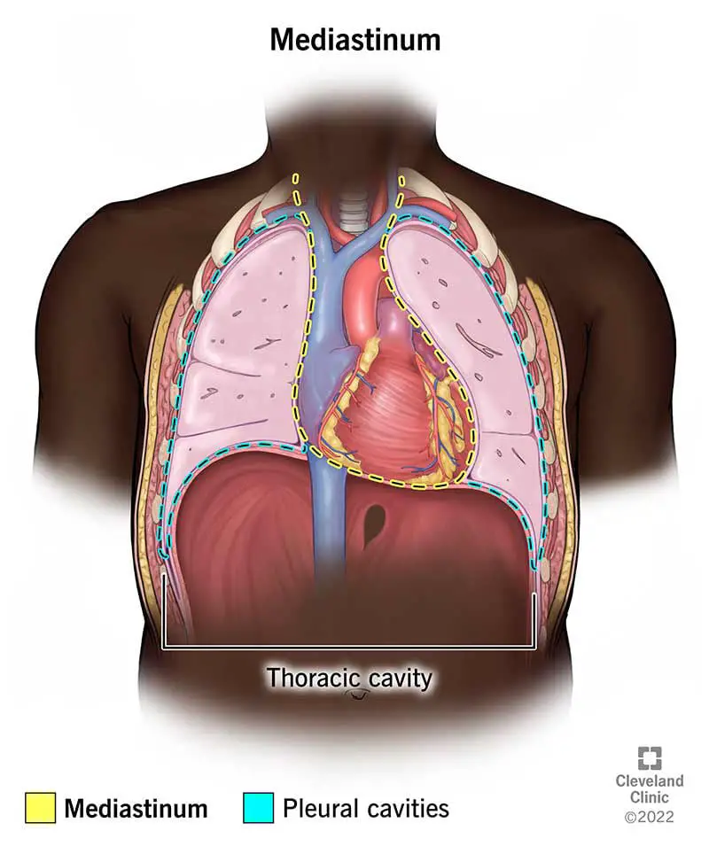 24113 mediastinum