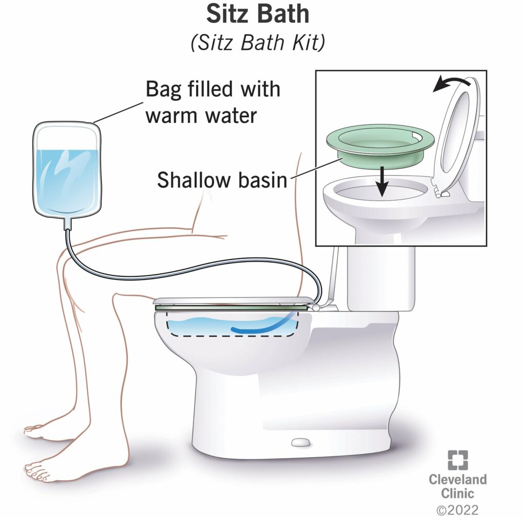 24137 sitz bath