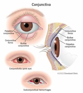 24329 conjunctiva