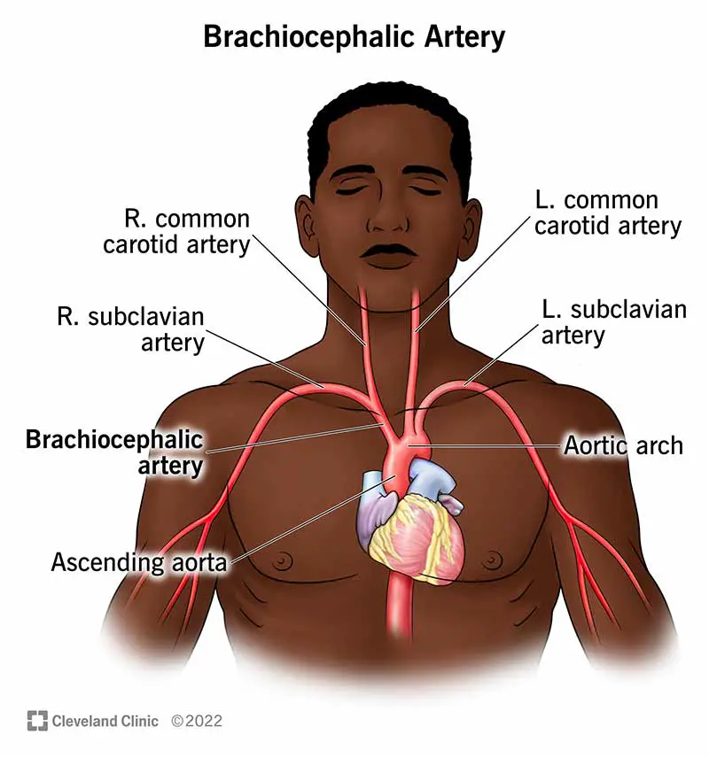 24410 brachiocephalic artery illustration