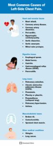 25119 left side chest pain cv