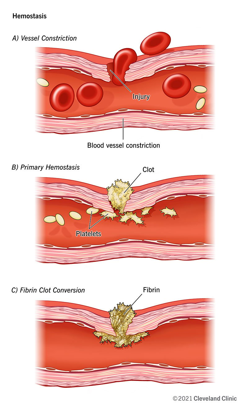 Hemostāzes laikā jūsu ķermenis aizbāž asiņojošu brūci un izmanto šo aizbāžņu kā sākumpunktu traumas labošanai.