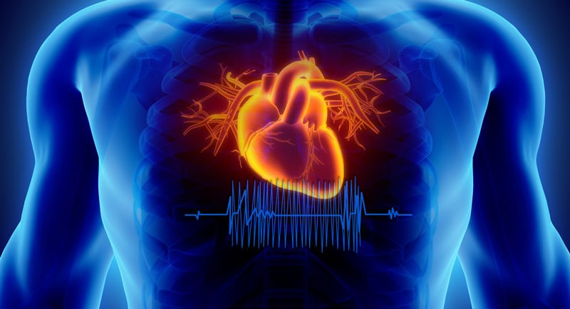 23055 holosystolic murmur