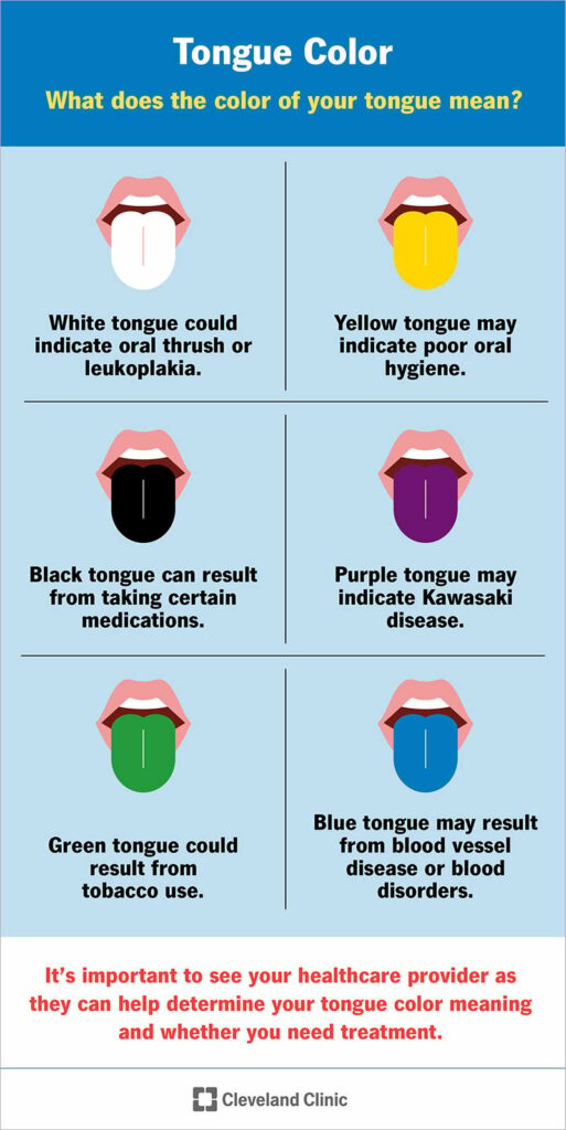 24600 tongue color