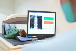 25077 bone density test