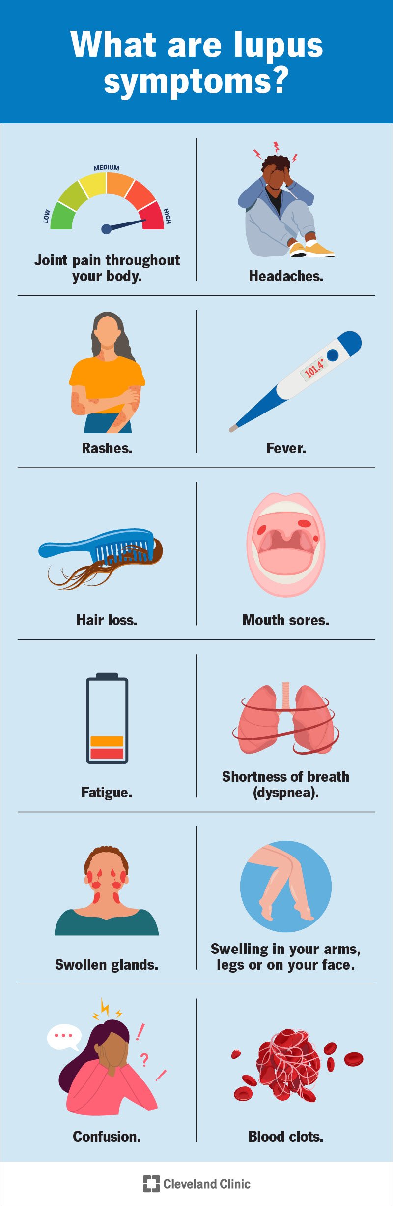 Lupus izraisa simptomus visā ķermenī.