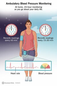 16330 ambulatory blood pressure monitoring.ashx