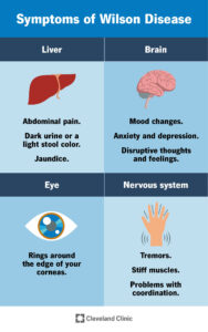 1705185378 5957 wilson disease