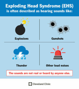 1705623975 21907 exploding head syndrome ehs