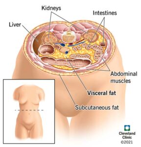 1706016926 24147 visceral fat