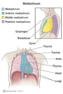 1706021486 13792 mediastinal tumors