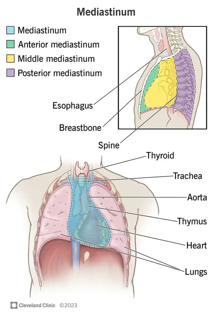 1706021486 13792 mediastinal tumors