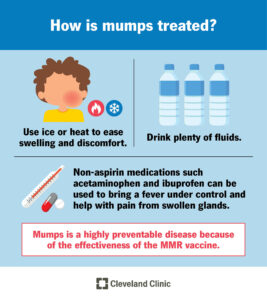 1706560578 15007 mumps