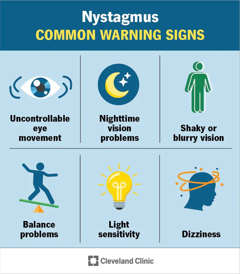 22064 nystagmus infographic