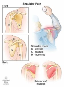 25122 shoulder pain