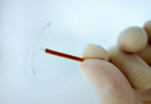 IUD 981523390 770x533 1