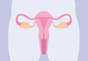 pcos uterusOvaries 1169701391 770x533 1