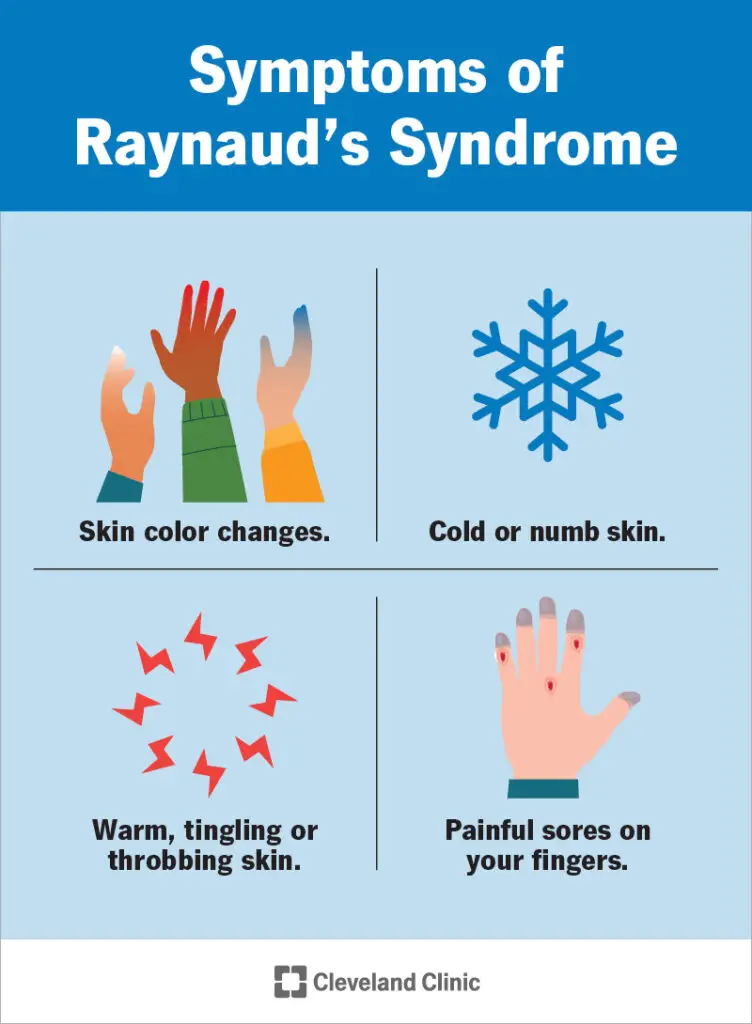 1707145452 9849 raynauds syndrome