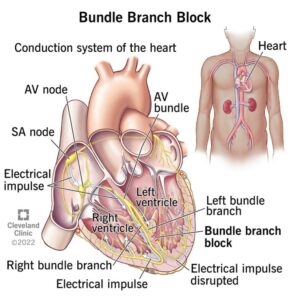 1708735639 22938 bundle branch blocker