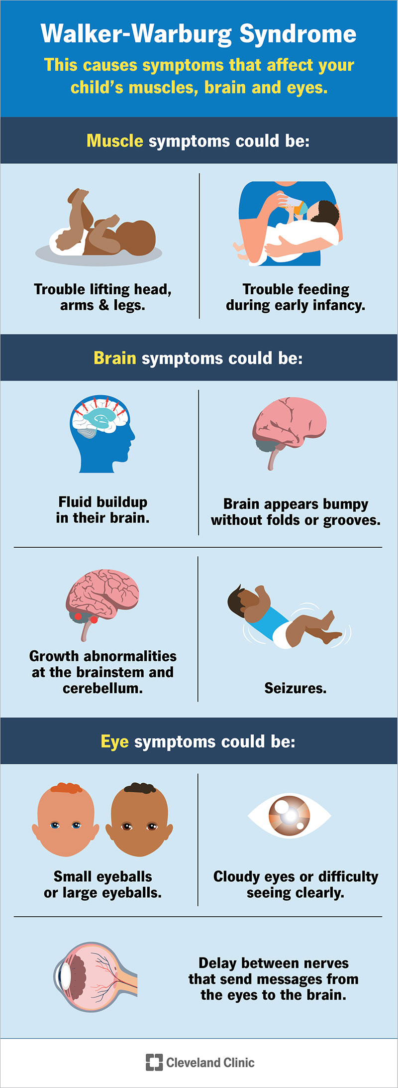 Walker-Warburg sindroma simptomu saraksts, kas ietekmē bērna muskuļus, smadzenes un acis.