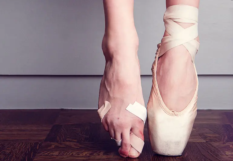 ballerina feet bruises bandaids 177683142 770x533 1