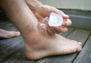 iceAnkle 1156749652 770x553