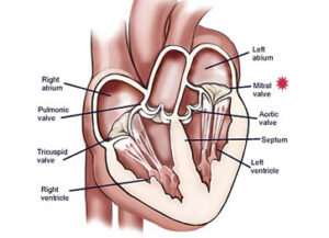 mvr 01 inside heart mitral valve.ashx