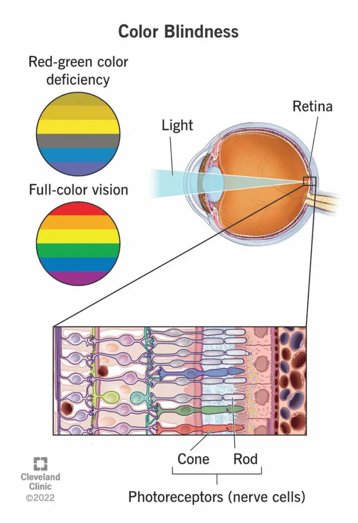 11604 color blindness