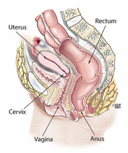 15428 abnormal uterine.ashx