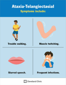 1709819178 23415 ataxia telangiectasia