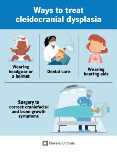 24090 cleidocranial dysplasia