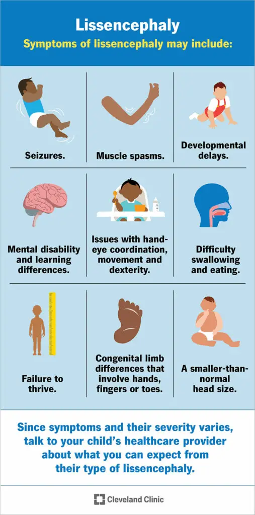 6033 lissencephaly