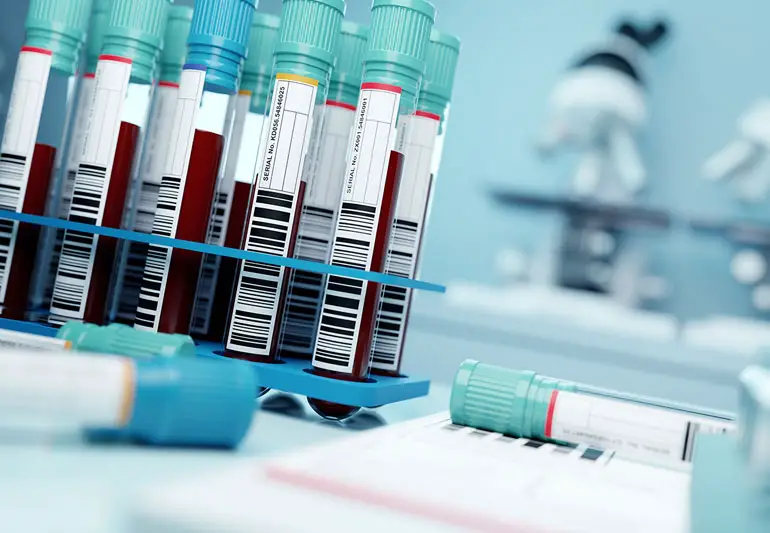 bloodTestSamples 1300036844 770x533 1