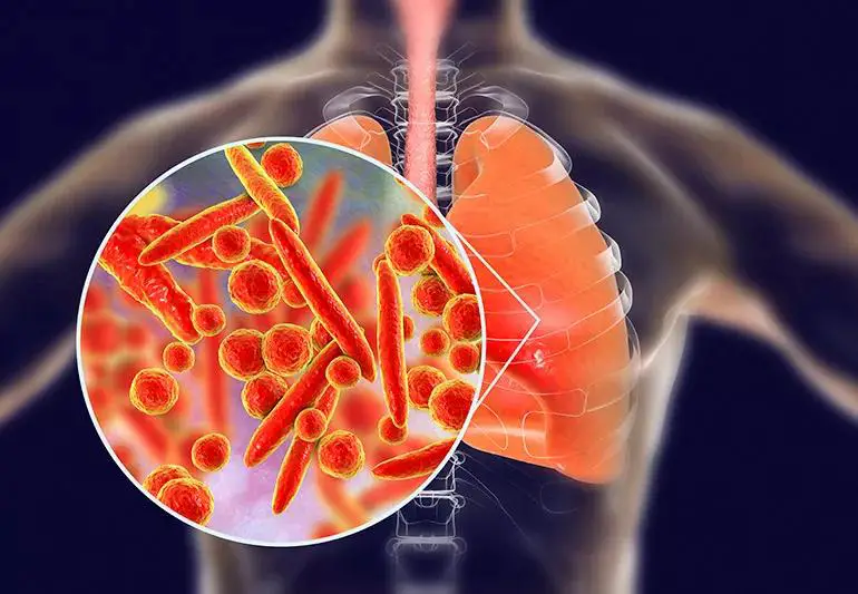 mycoplasma pneumoniae 943418028 jpg