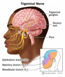 15671 trigeminal neuralgia