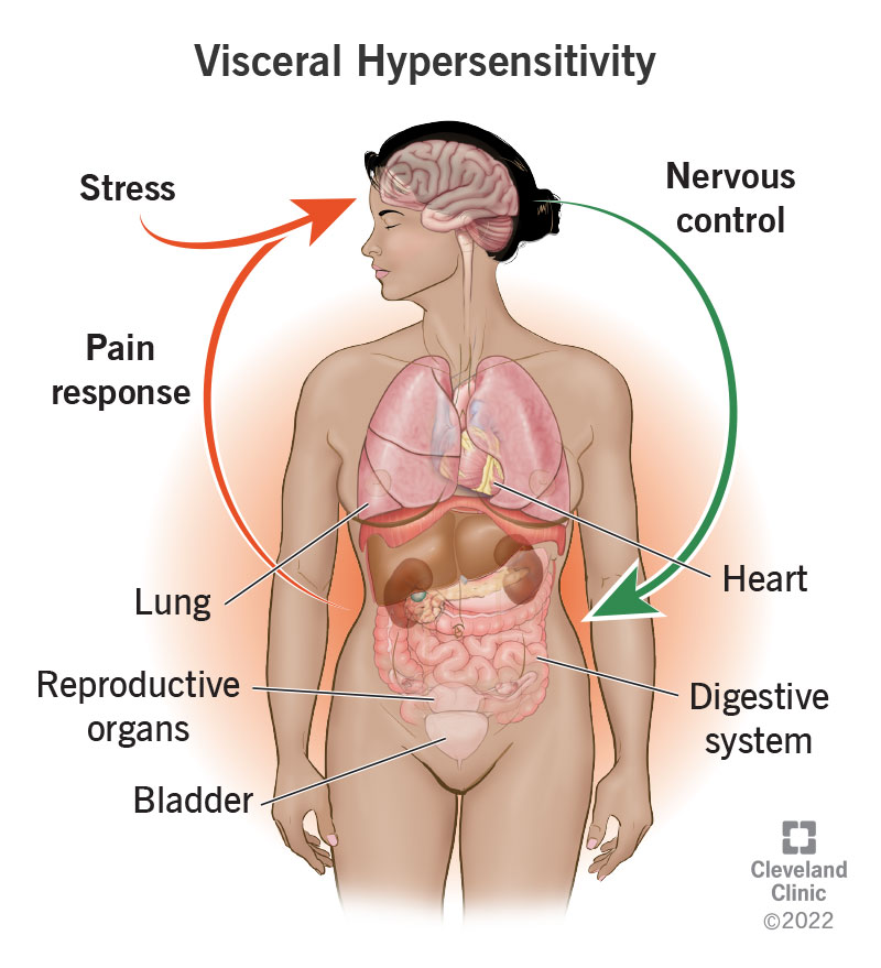 22997 visceral hypersensitivity