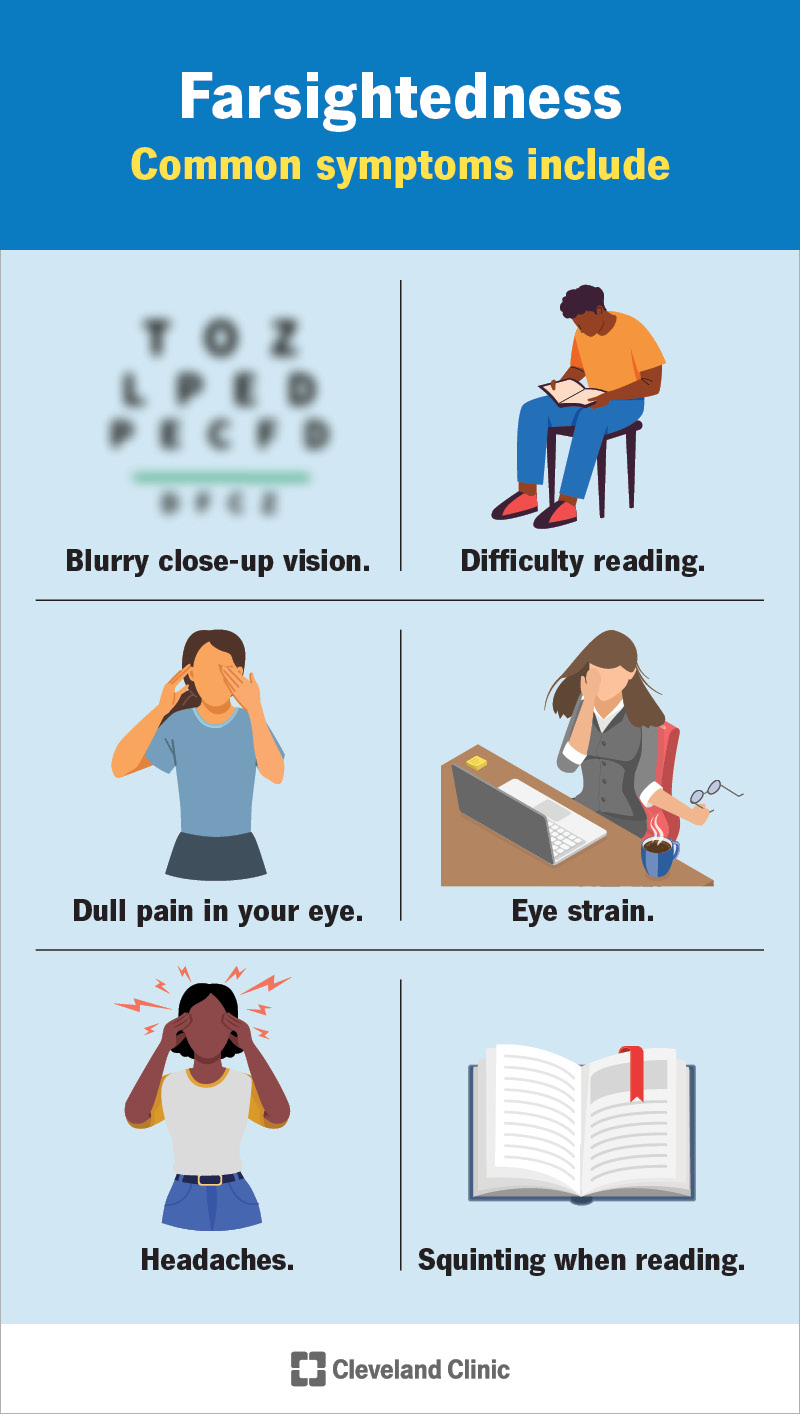 Hiperopijas simptomi ir acu nogurums, galvassāpes, šķielēšana lasīšanas laikā un daudz kas cits.
