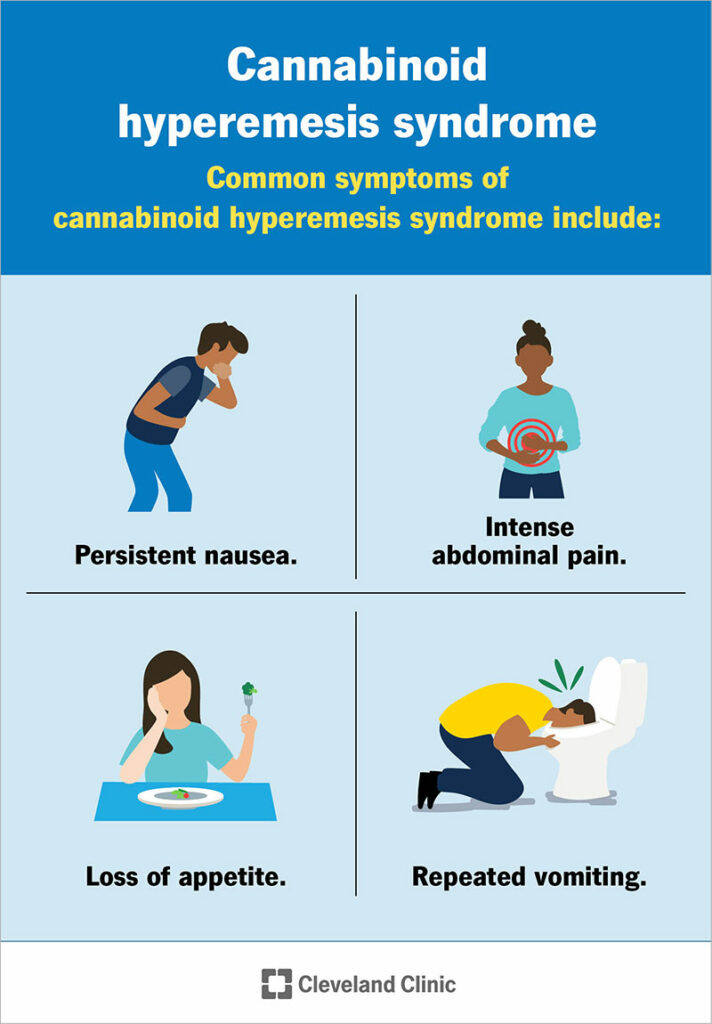 cannabinoid hyperemesis syndrome feature